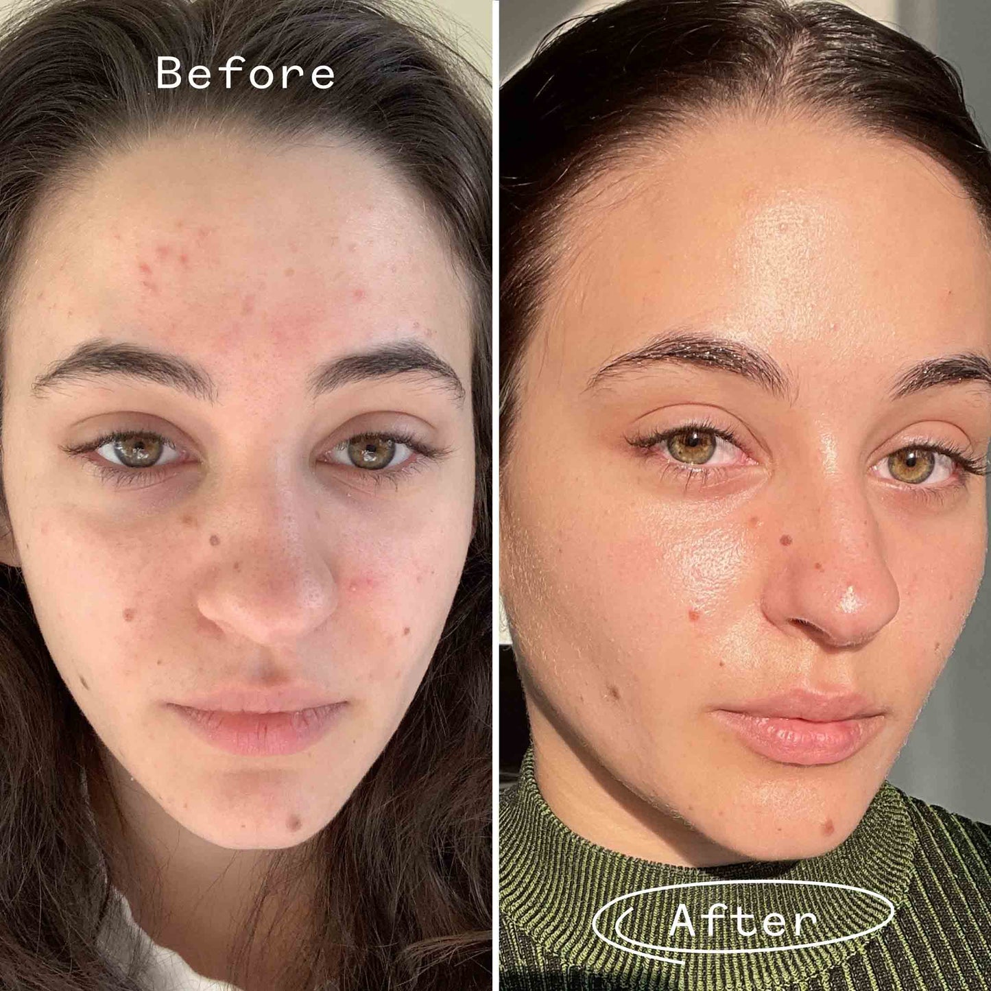 Carbon Star™ Face Oil Mini