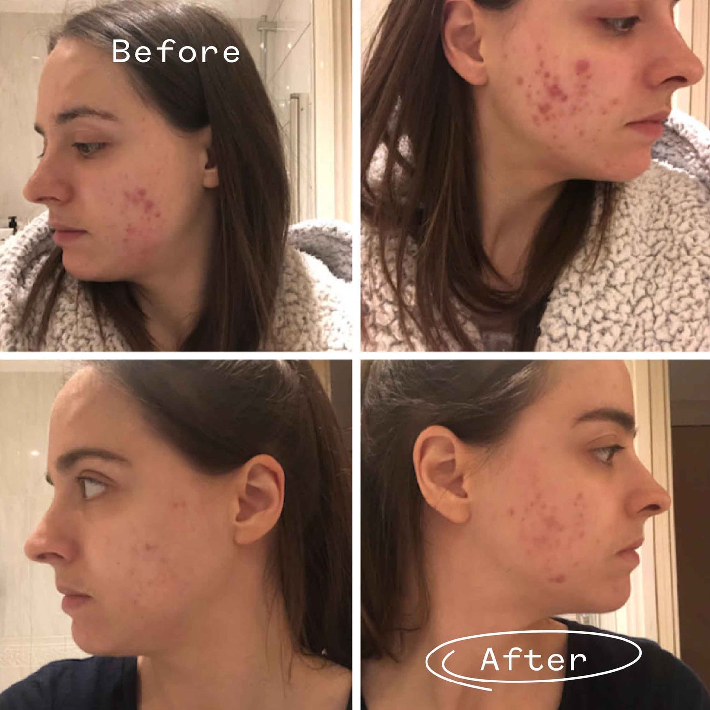 Instant Kalmer™ Serum