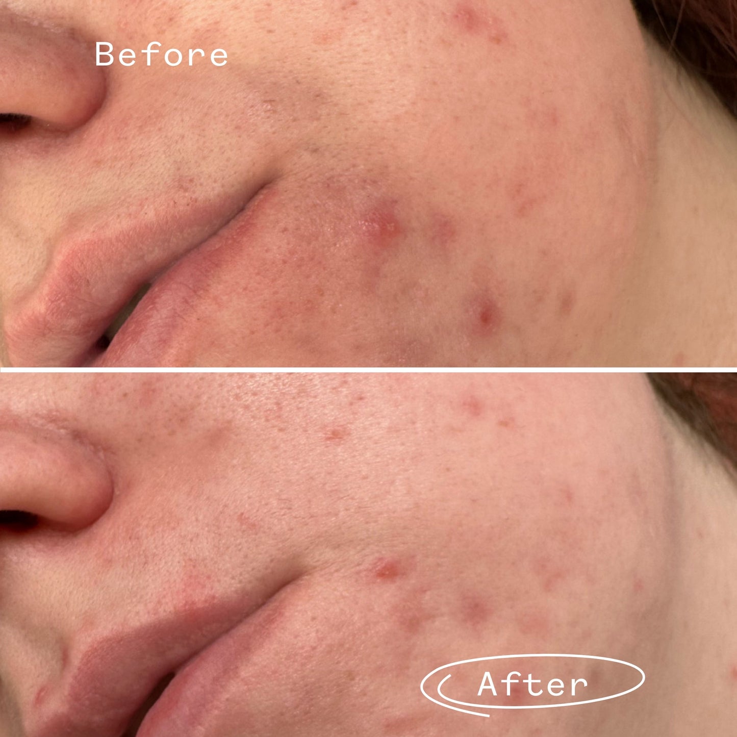 Phaze™ Gel Cleanser