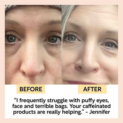 Eye Cream with Hyaluronic Acid + Coffee