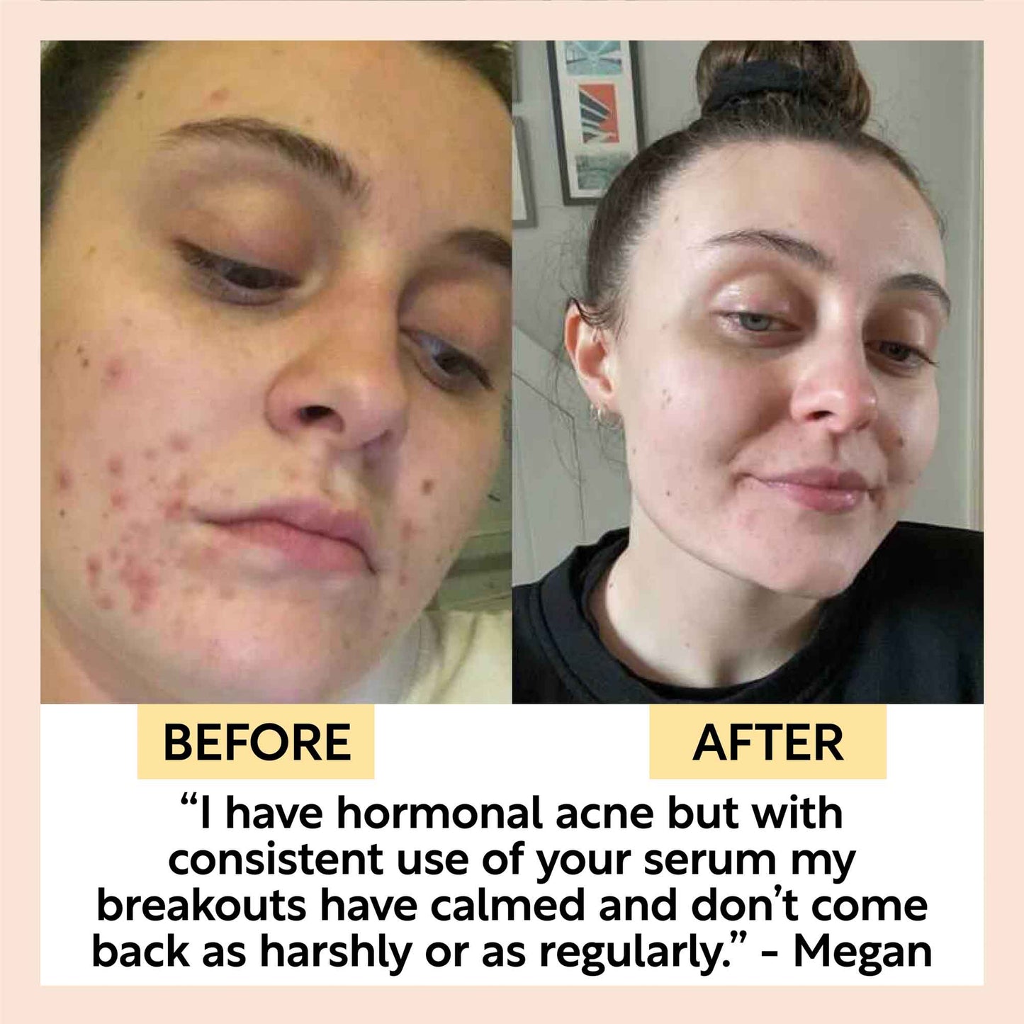 Hydration Skincare Set