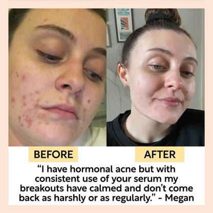 Hydration Skincare Set