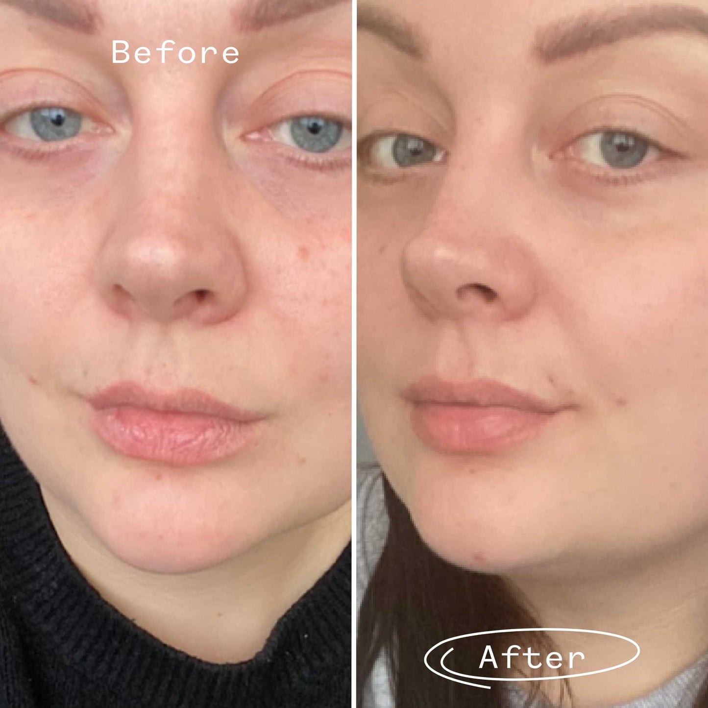 Rosehip Bioregenerate™ Face Oil