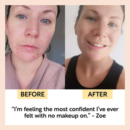 SPF 25 Mineral Sunscreen